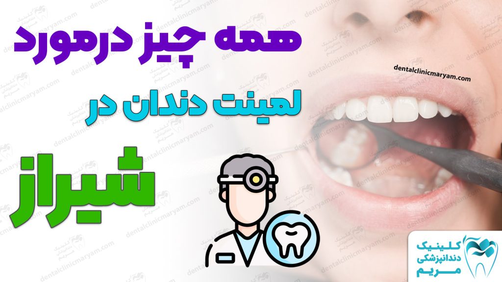 لمینت دندان شیراز