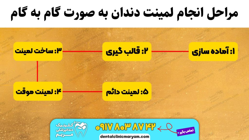مراحل لمینت دندان شیراز