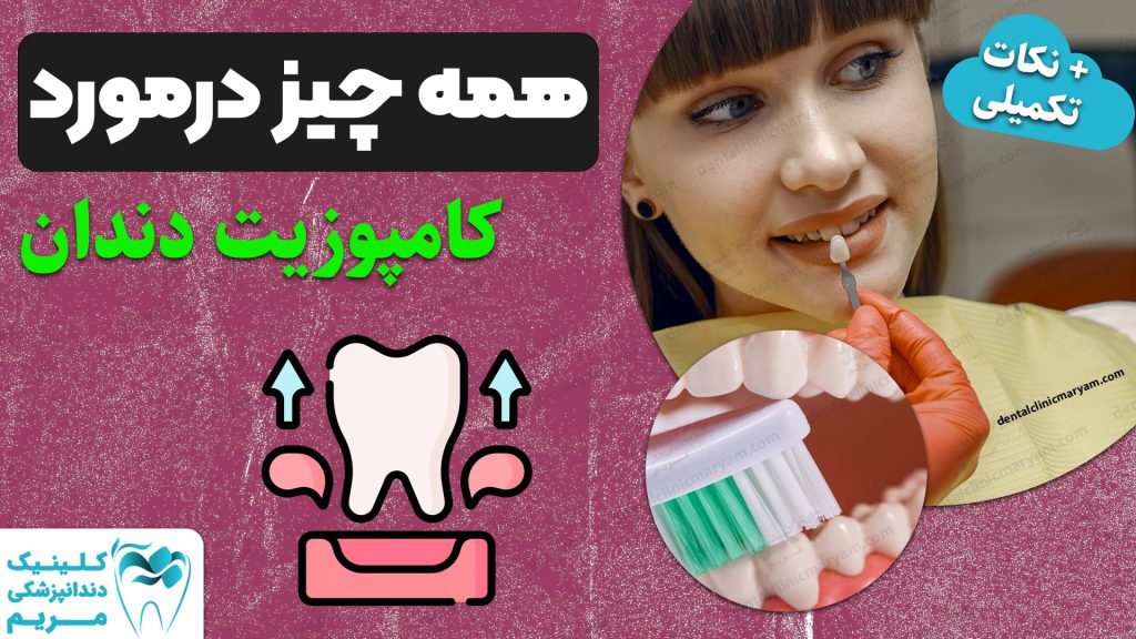کامپوزیت دندان شیراز