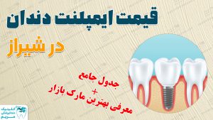 قیمت امپلنت دندان در شیراز