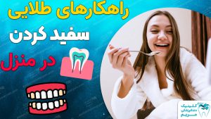 راهکار سفید کردن دندان در منزل
